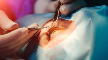 Глазная хирургия